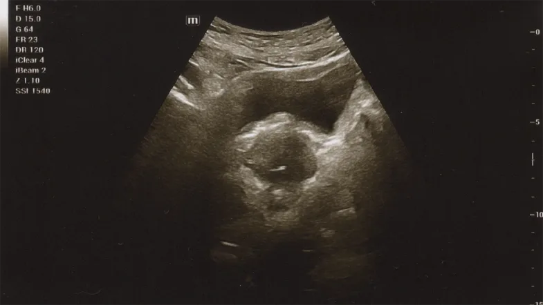 Foto hasil USG (Ultrasonografi) pertama, 15 Agustus 2025.